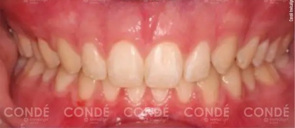 Condé – Invisalign Doctor